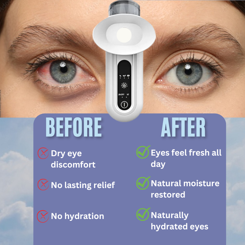 Gllowen™ Steam Dry Eye Therapy Wand